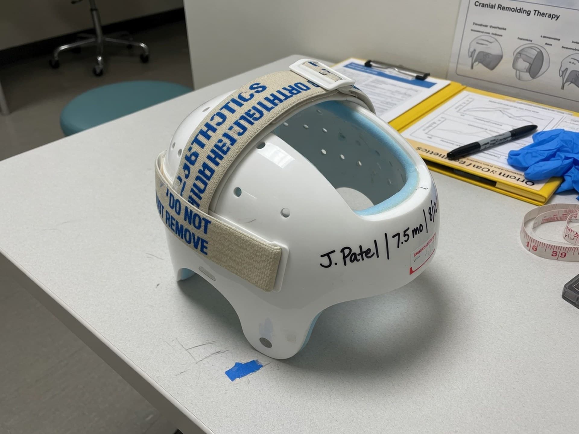 A 3D-printed cranial remolding helmet on a clinic table