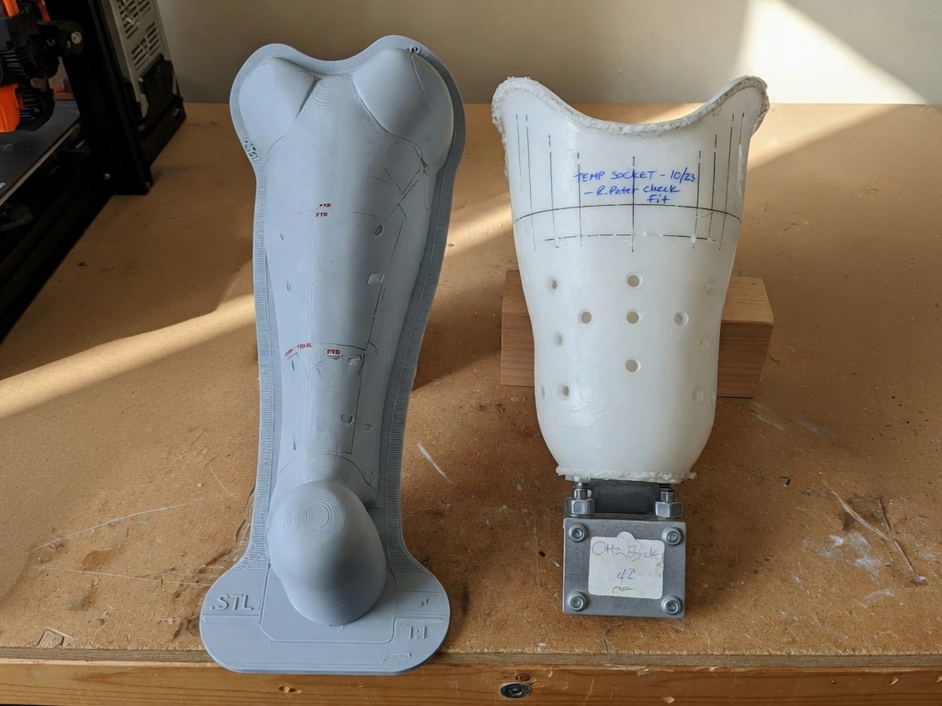 3D-printed limb mould and check socket