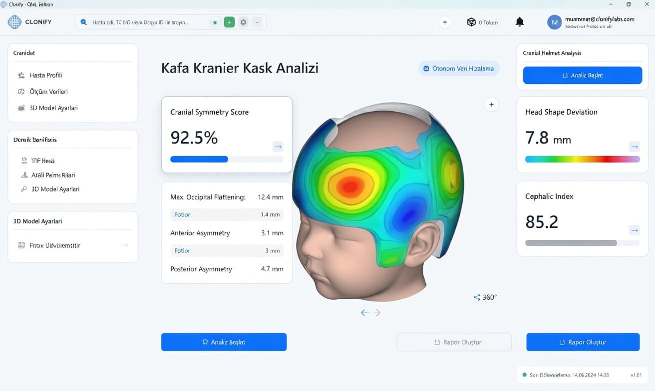 Clonify cranial helmet analysis screen: colour asymmetry map of an infant's head with cranial symmetry score and cephalic index values